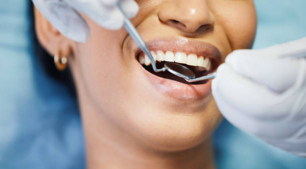 Best Walk-In Emergency Dental Services in New Paleste, IN