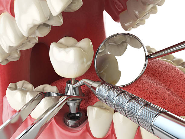 Best Emergency Treatment for Jaw Pain or Injury in New Paleste, IN
